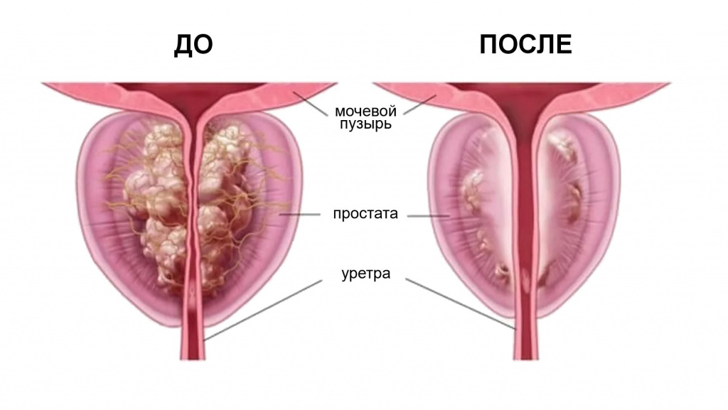 rezum-do-posle-novosibirsk.jpg rezum-do-posle-novosibirsk.jpg